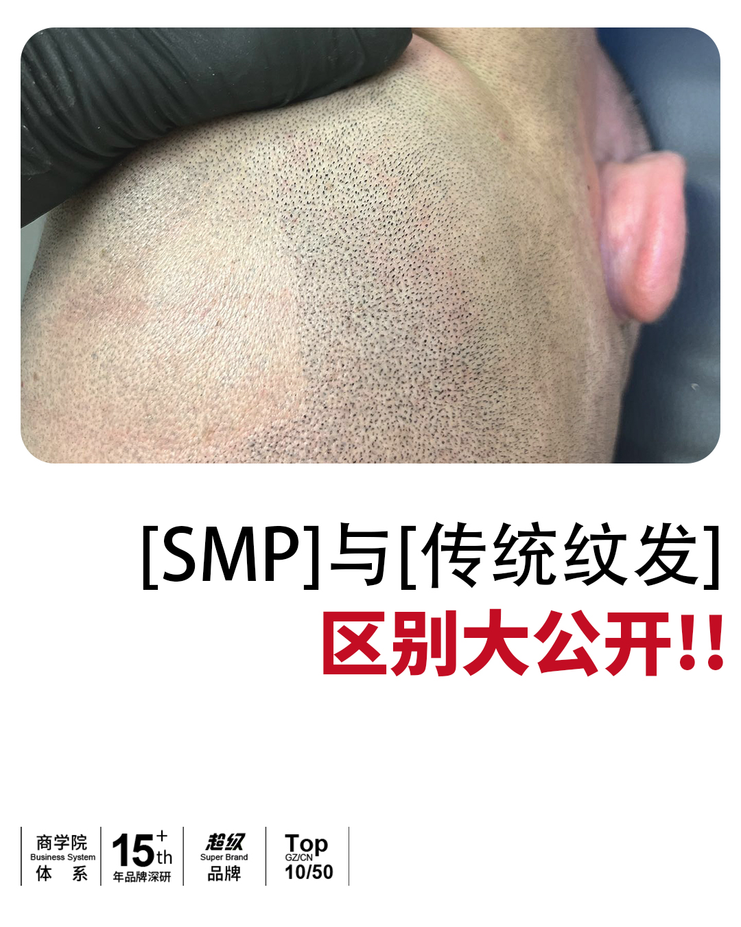 [SMP]与[传统纹发]区别大公开！！