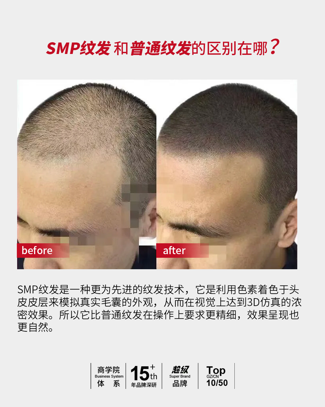 SMP纹发大解析！！一秒看懂SMP纹发！